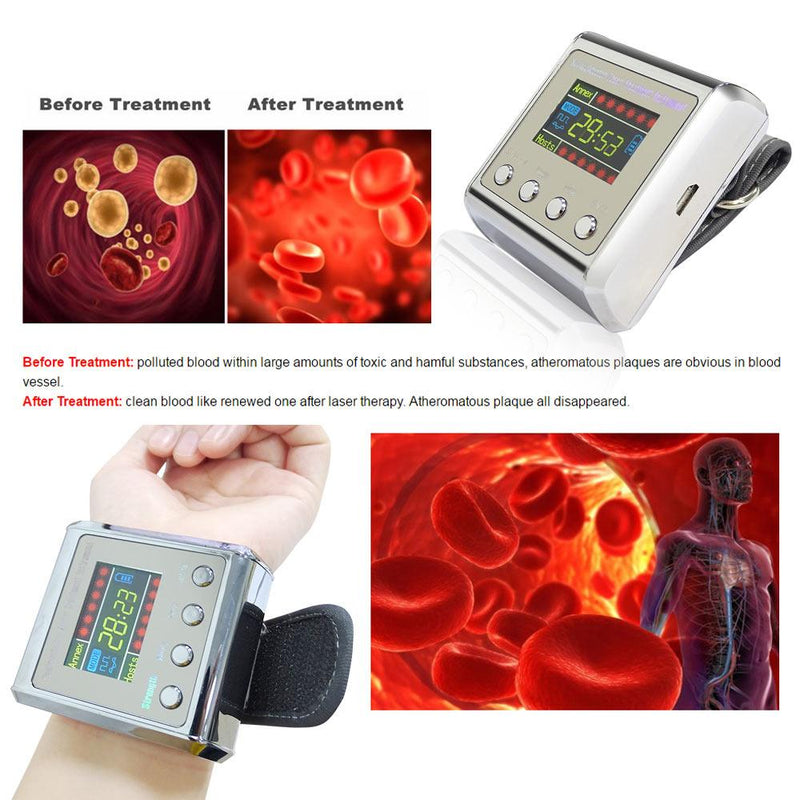 Hypertension Laser Therapy Watch - ClickerMans